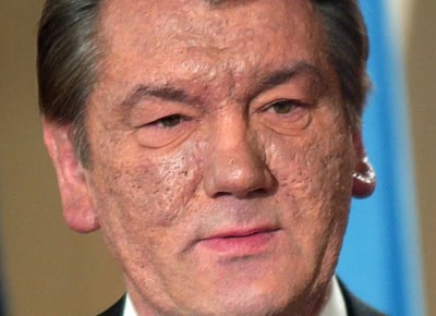 Лепра